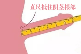 汕头做包茎手术哪里好点 - 汕头做包皮手术要多少钱吗