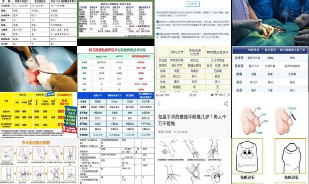 汕头包皮手术大概需要多少