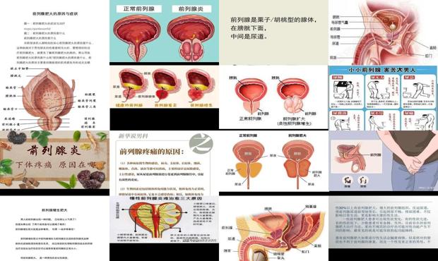 汕头前列腺是啥原因引起的