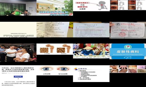 汕头炎症感染是怎么回事