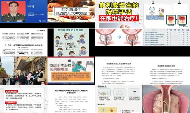 汕头前列腺增生治疗方法怎么选择