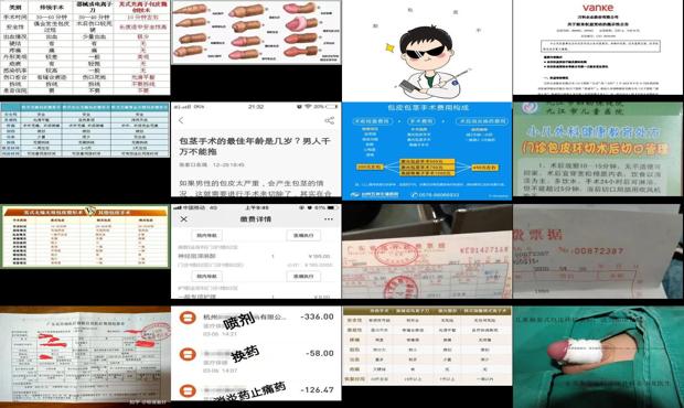 汕头男性包皮手术费用多少
