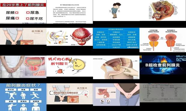 汕头得了前列腺炎是什么感觉