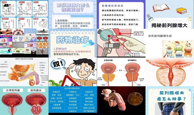 汕头前列腺増大要怎么治疗