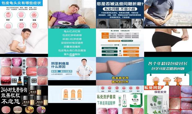 汕头包皮刺痛