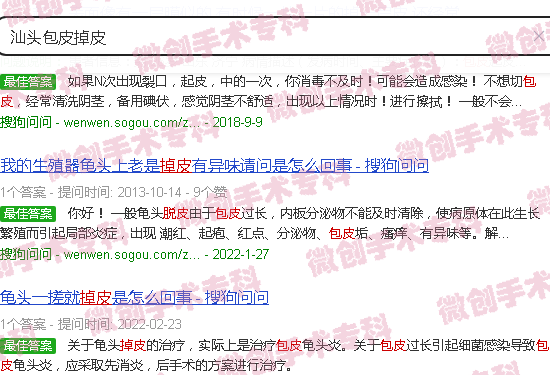 汕头包皮掉皮