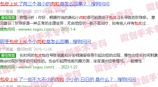 汕头包皮上长肉粒