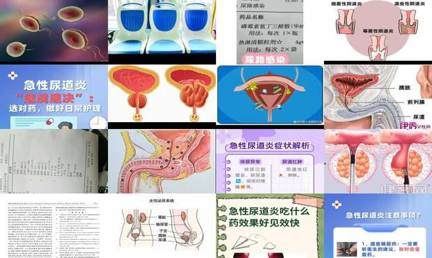 汕头急性尿道炎症