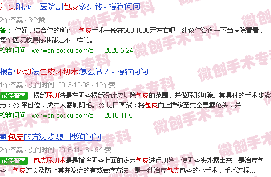 汕头包皮环切