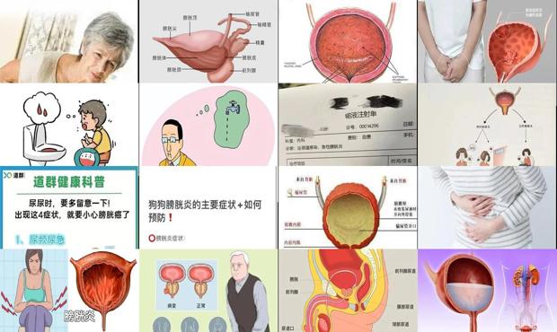 汕头膀胱发炎症状