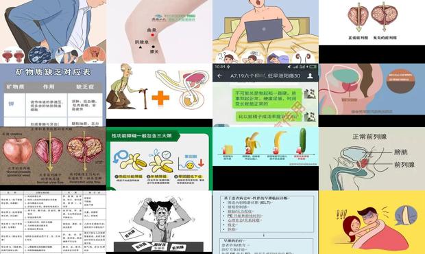 汕头前列腺炎勃起障碍症是那些物质多