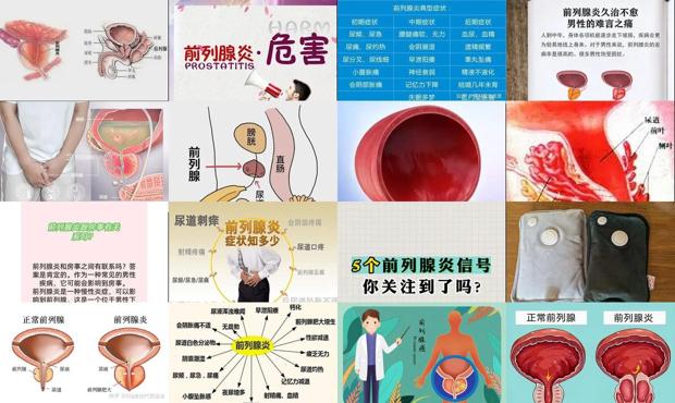 汕头前列腺炎有口感的症状吗