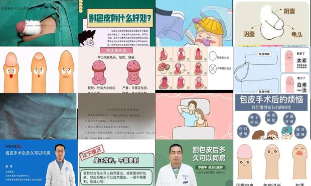 汕头割包皮多久可以同房