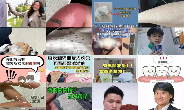汕头男的下面有炎症