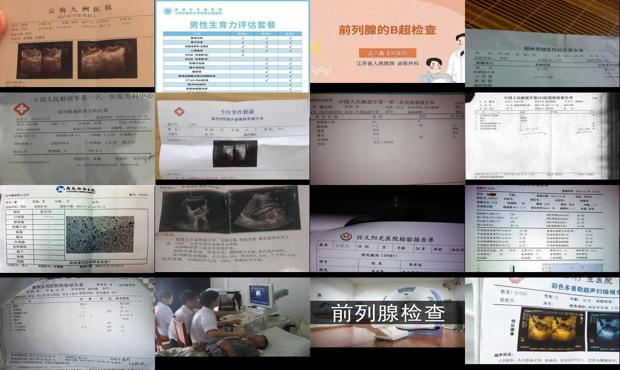 汕头医院检查前列腺怎么查的