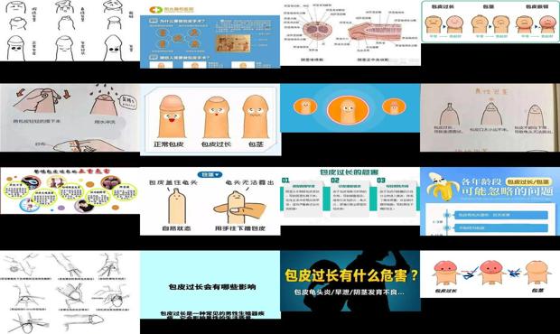 汕头包皮过长的原因