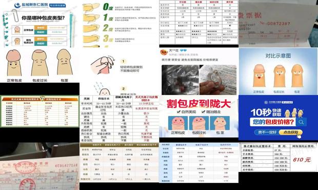 汕头男人躯体化障碍的症状