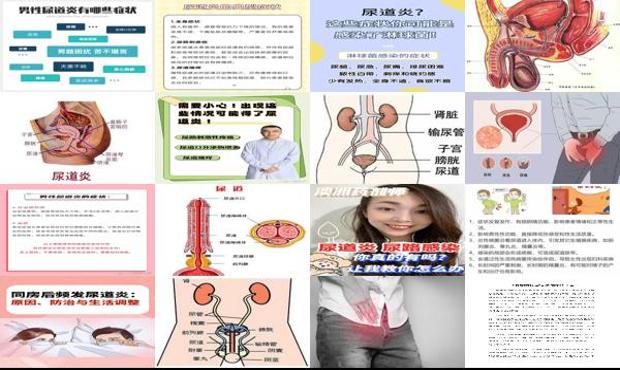 汕头尿道炎症状表现如何*解决