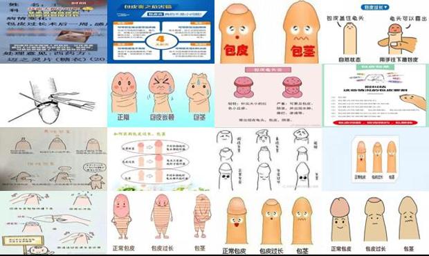 汕头包皮太长会怎么样