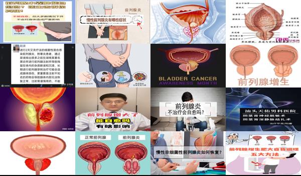 充血前列腺炎症怎么治 - 汕头充血前列腺能自愈吗