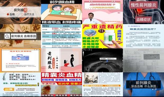 汕头前列腺炎导致血精的*治疗