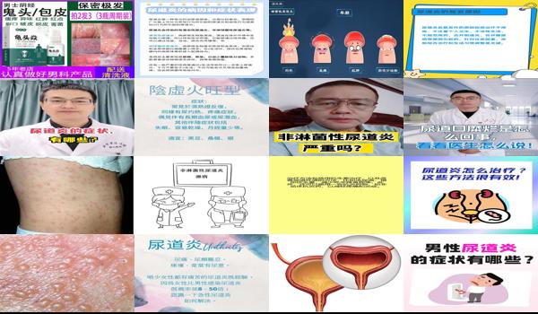 尿道炎症状男性怎么办 - 汕头尿道炎症状表现男