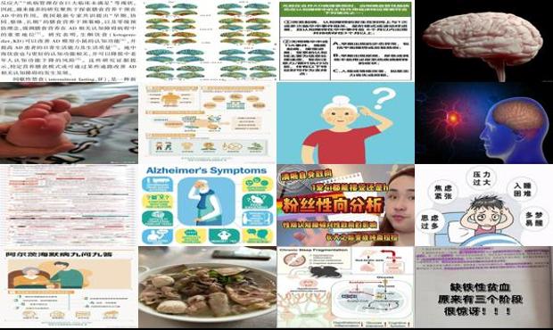 汕头认知性障碍
