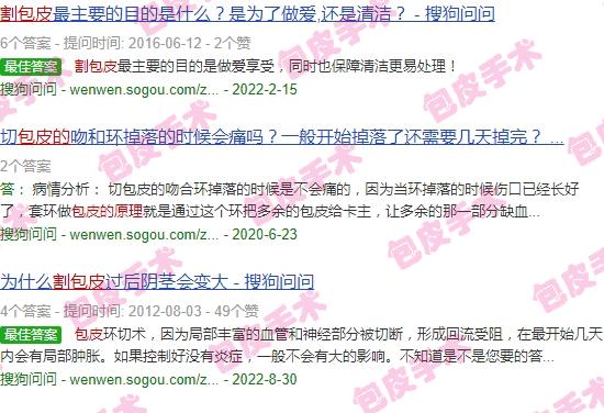汕头割包皮价格 - 汕头割包皮的原理