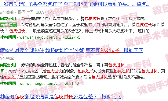 汕头包皮怎样算过长