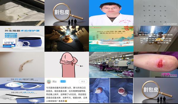 汕头割包皮需要多少钱 - 汕头割包皮后伤口愈合图片