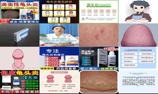汕头滴虫龟头炎症状