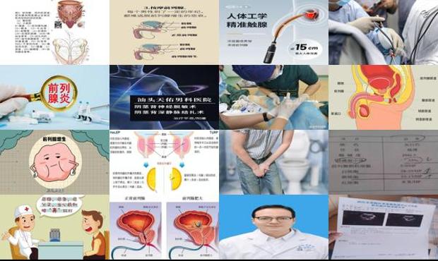 汕头前列腺尿道冲洗有用么