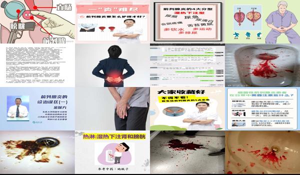 汕头前列腺炎吐血医生 - 汕头前列腺炎吐血