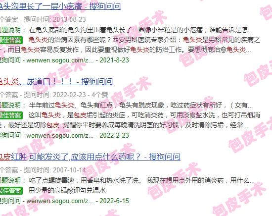 滴虫性包皮炎的主要症状 - 汕头滴虫性包皮龟头炎