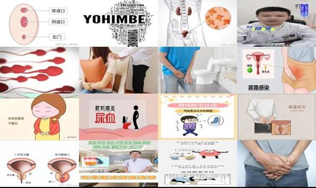 汕头尿道炎症怎么办