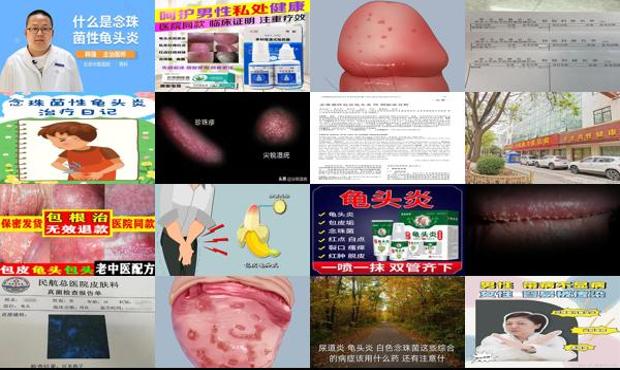 汕头念珠性龟炎症状
