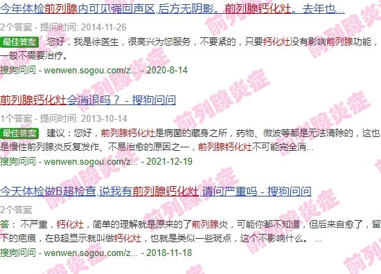 30岁 前列腺钙化灶 - 汕头30岁前列腺钙化灶