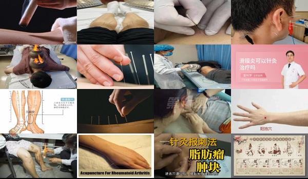 汕头针灸可以治疗睾丸炎症吗多少钱 - 汕头针灸可以治疗睾丸炎症吗