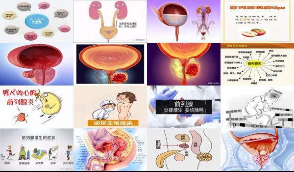 前列腺炎汕头哪个医院好 - 汕头前列腺炎症有什么影响