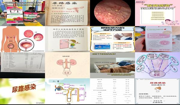 尿路有炎症,怎样才好 - 汕头尿路有炎症怎么办