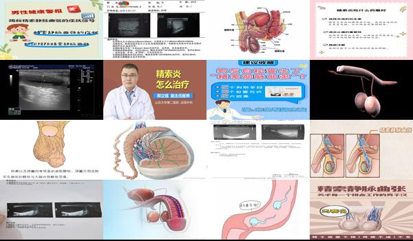 汕头附一治疗精索静脉曲张 - 汕头男性精索炎症状图片