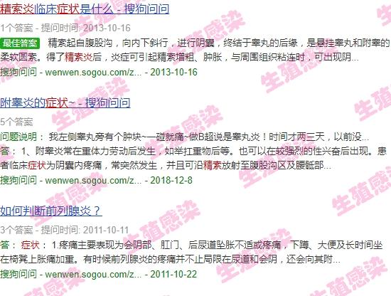 汕头附一治疗精索静脉曲张 - 汕头男性精索炎症状图片