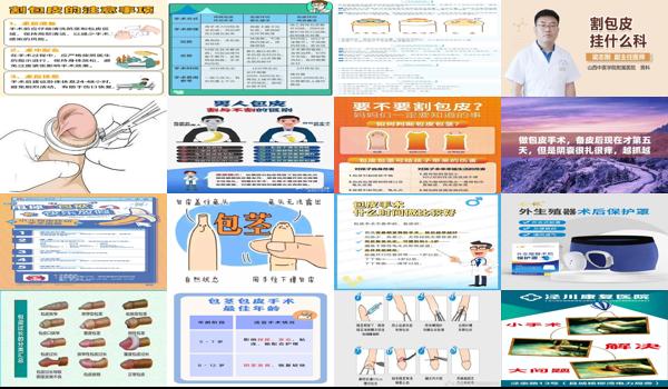 汕头包皮手术属于什么科室的 - 汕头包皮手术属于什么科