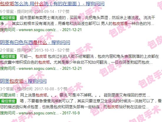 包皮垢是什么意思? - 汕头包皮垢是什么