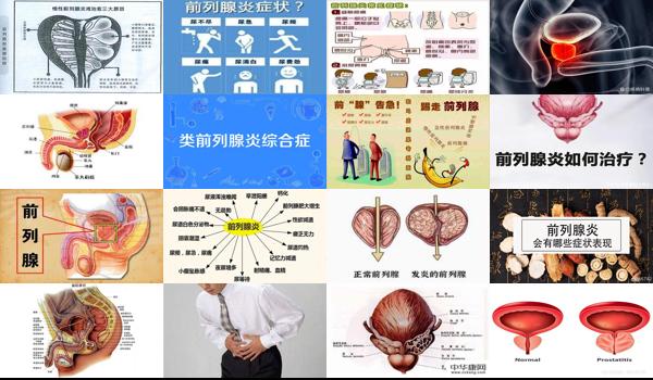 汕头前列腺炎综合症医院* - 汕头前列腺炎综合症