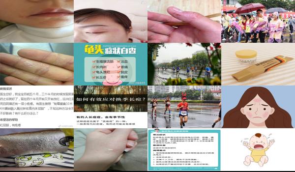 包皮头上长红疙瘩 - 汕头包皮上有红疹怎么回事