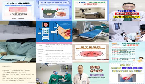 汕头中心医院前列腺检查多少钱一次 - 汕头前列腺做什么检查