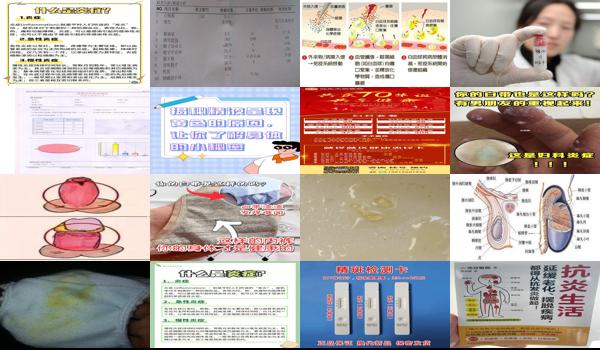 汕头哪里可以验男女 - 汕头怎么查精液是不是有炎症