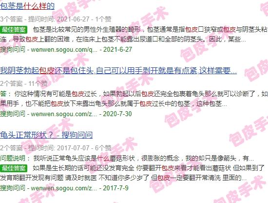 汕头包皮手术多少钱 - 汕头包皮长什么样