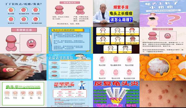 汕头龟的图片 - 汕头龟头上有痘痘,炎症引起的